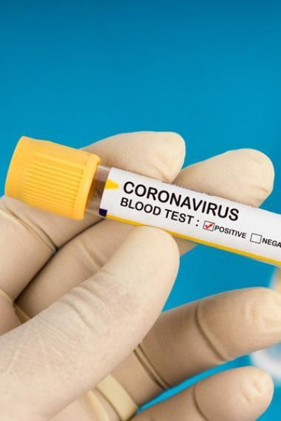 Caratula, cartel, poster o portada de Coronavirus, cómo comenzó todo