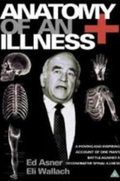 Caratula, cartel, poster o portada de Anatomy of an Illness