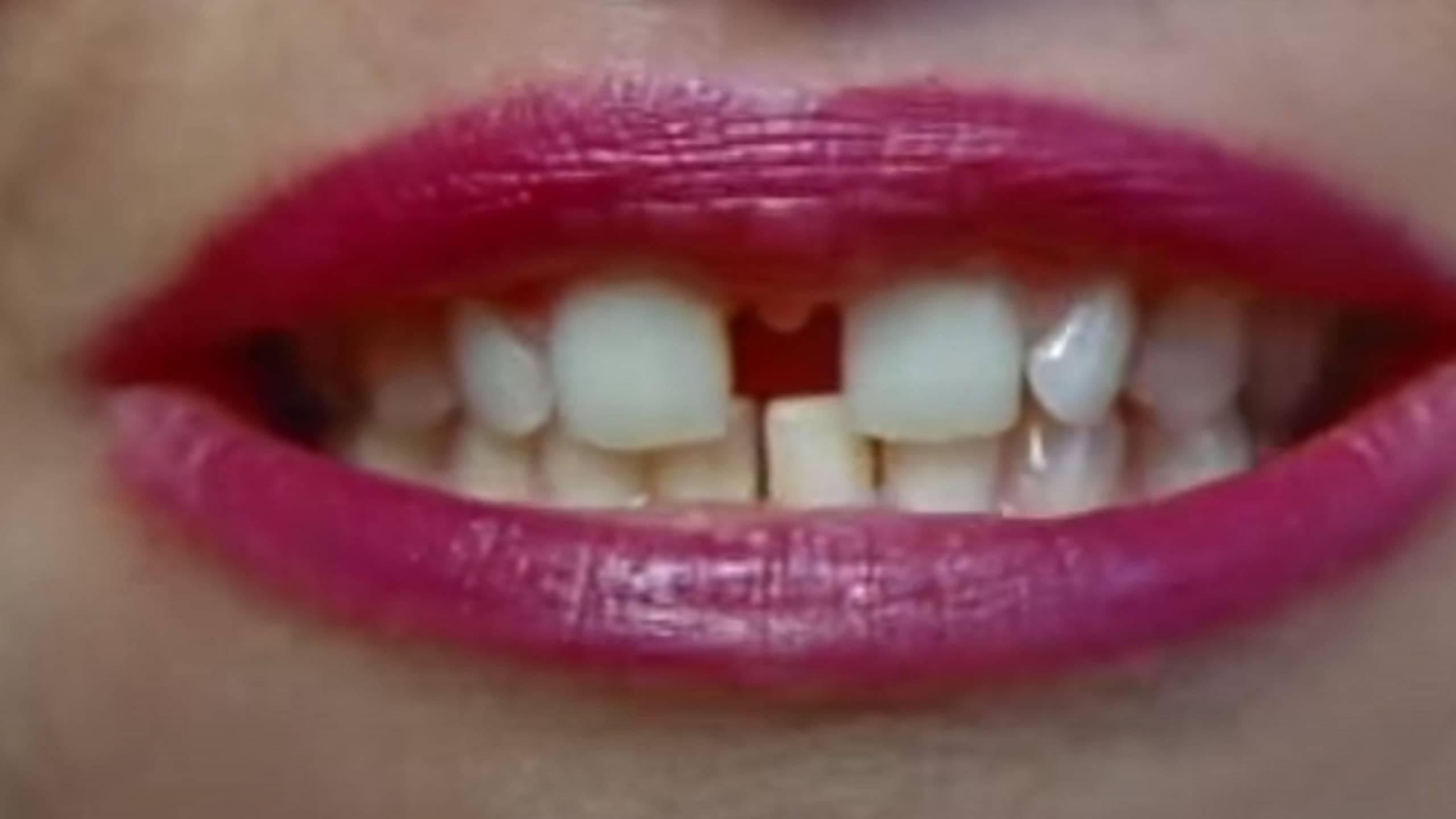 Cubierta de Gap-Toothed Women